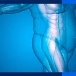 Obesity was once considered a disease of adults