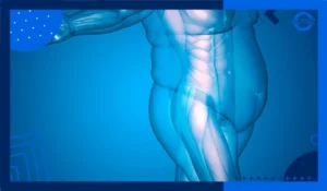 Obesity was once considered a disease of adults