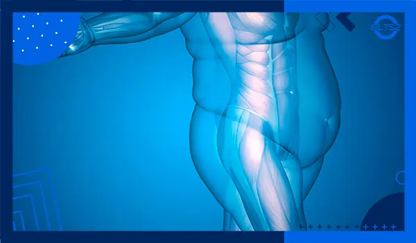 Obesity was once considered a disease of adults